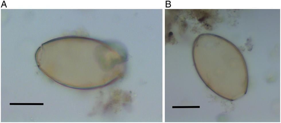 Intestinal parasites in the Neolithic population who built Stonehenge