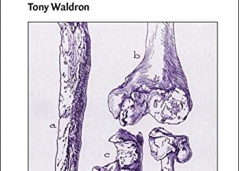 Palaeopathology (Cambridge Manuals in Archaeology)