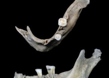 2,000 year old teeth analysis provides hints about the diet of an Iron Age woman