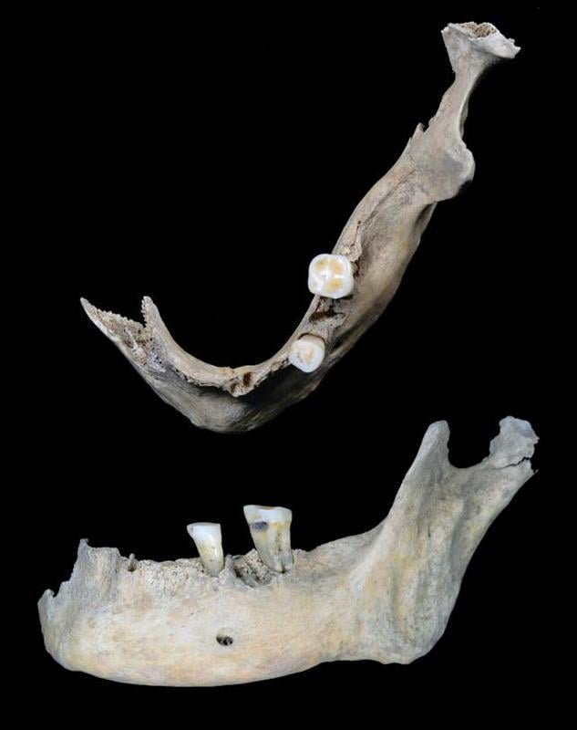 2,000 year old teeth analysis provides hints about the diet of an Iron Age woman