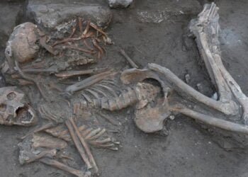 Archaeologists uncovered early evidence of cranial surgery in ancient Near East