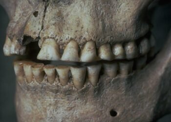 Ancient teeth reveal secrets of HSV-1 virus spread and evolution