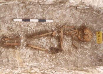 Ancient DNA reveals West African ancestry in 7th-century skeletons from England. Skeleton of the girl with West African ancestry buried at Updown, Kent. Credit: Duncan Sayer et al, Antiquity (2025). CC BY 4.0