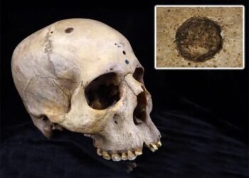 Ancient Egyptian doctors tried to treat cancer 4,000 years ago