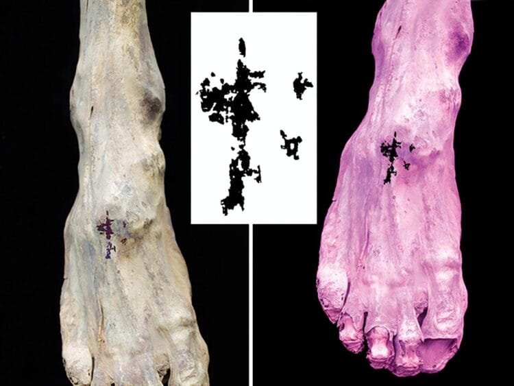 New study uncovers rare Christian tattoo in medieval Nubia