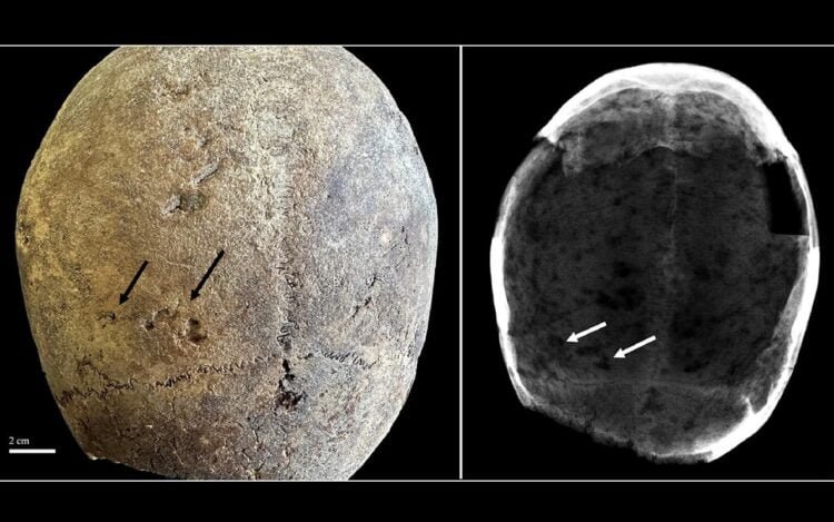 Discovery of cocaine use in 17th-century Europe challenges historical assumptions