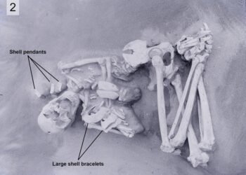 The mystery of cranial modification in ancient Japan is solved
