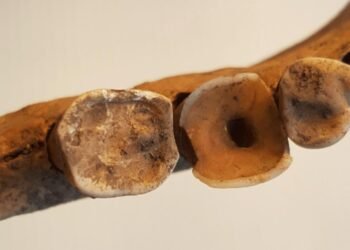 Uncovering advanced dentistry practices among Vikings