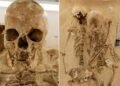 DNA reveals rare dwarfism in teenager who lived in Italy 12,000 years ago