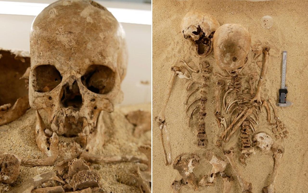 DNA reveals rare dwarfism in teenager who lived in Italy 12,000 years ago