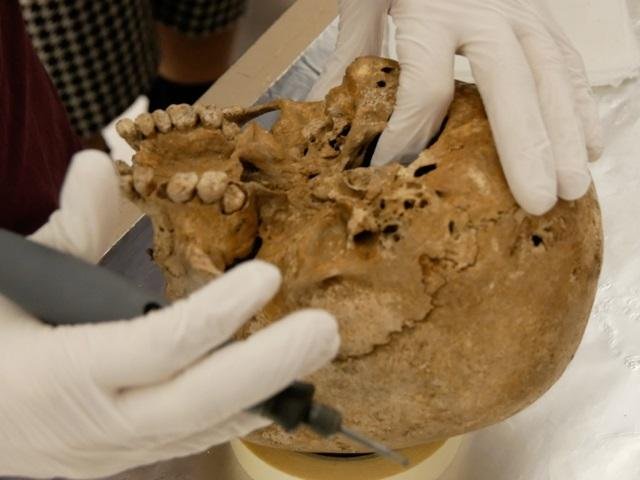 DNA reveals rare dwarfism in teenager who lived in Italy 12,000 years ago