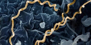 5,500-year-old human skeleton in Colombia reveals earliest evidence of syphilis in the Americas