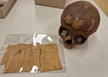 "Study reveals Ephesos skull is not Cleopatra’s sister, but that of an 11-year-old boy."