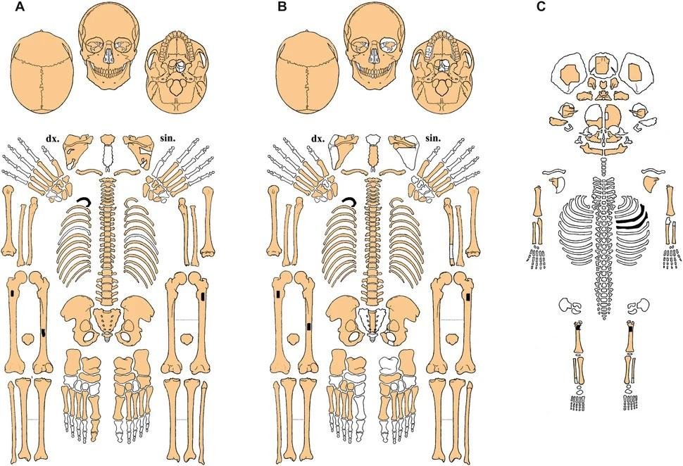 Reconstructions reveal faces of Neolithic sisters buried 6,000 years ago