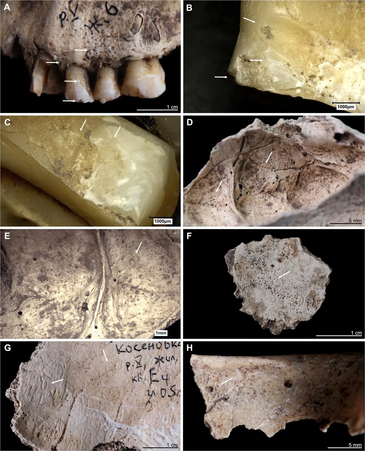 Stone Age family killed in house fire 6,000 years ago, study reveals