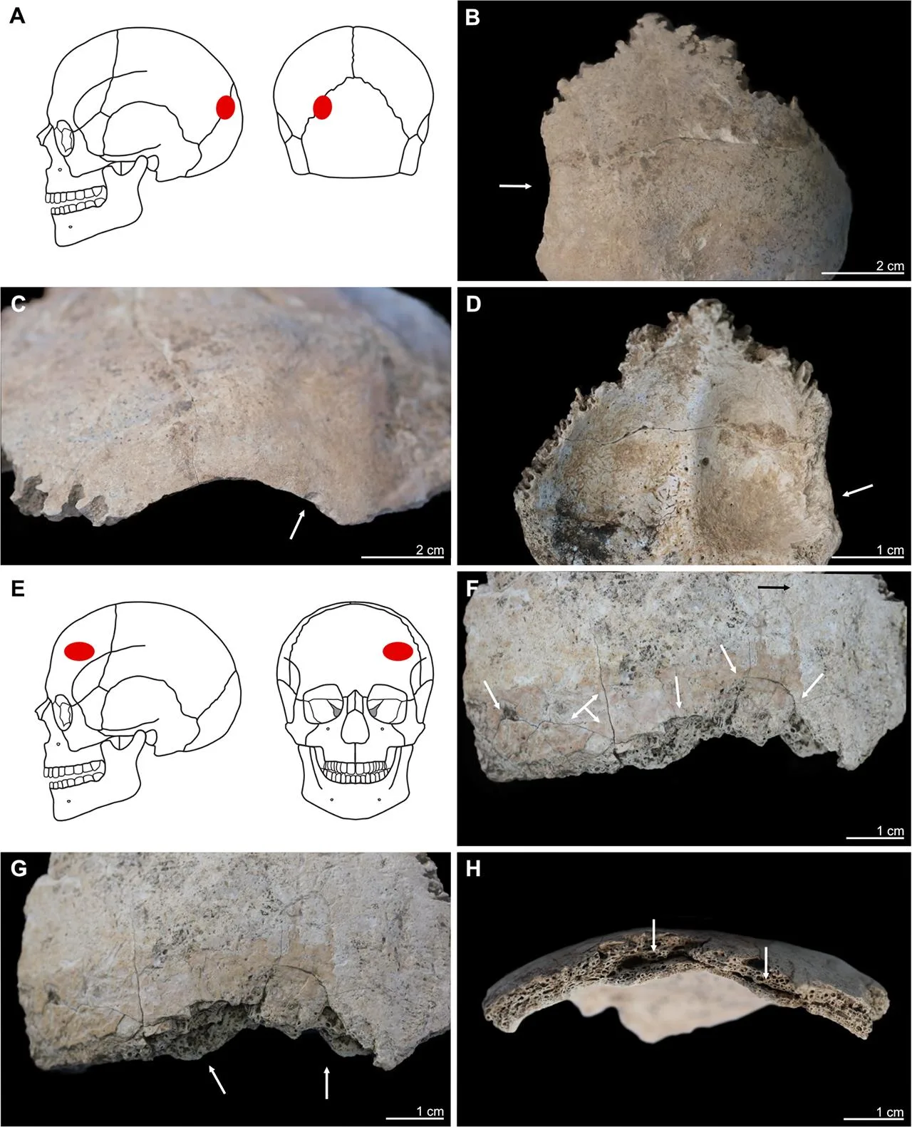 Stone Age family killed in house fire 6,000 years ago, study reveals