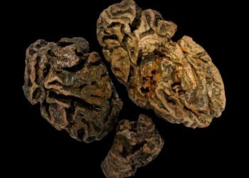 New study challenges beliefs on human brain preservation across millennia