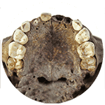 Bioarchaeology