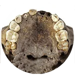 Bioarchaeology