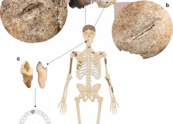 Langobard woman with healed skull injuries challenges assumptions about violence in early medieval society