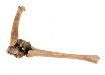 Medieval man with crippled knee reveals disability care in Sweden