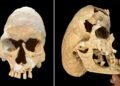 Medieval warrior-monk with extreme skull deformity discovered at Spanish fortress
