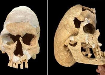 Medieval warrior-monk with extreme skull deformity discovered at Spanish fortress