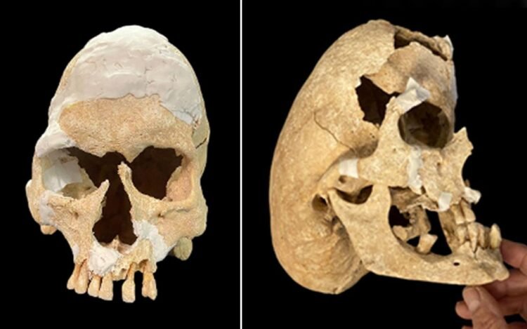 Medieval warrior-monk with extreme skull deformity discovered at Spanish fortress