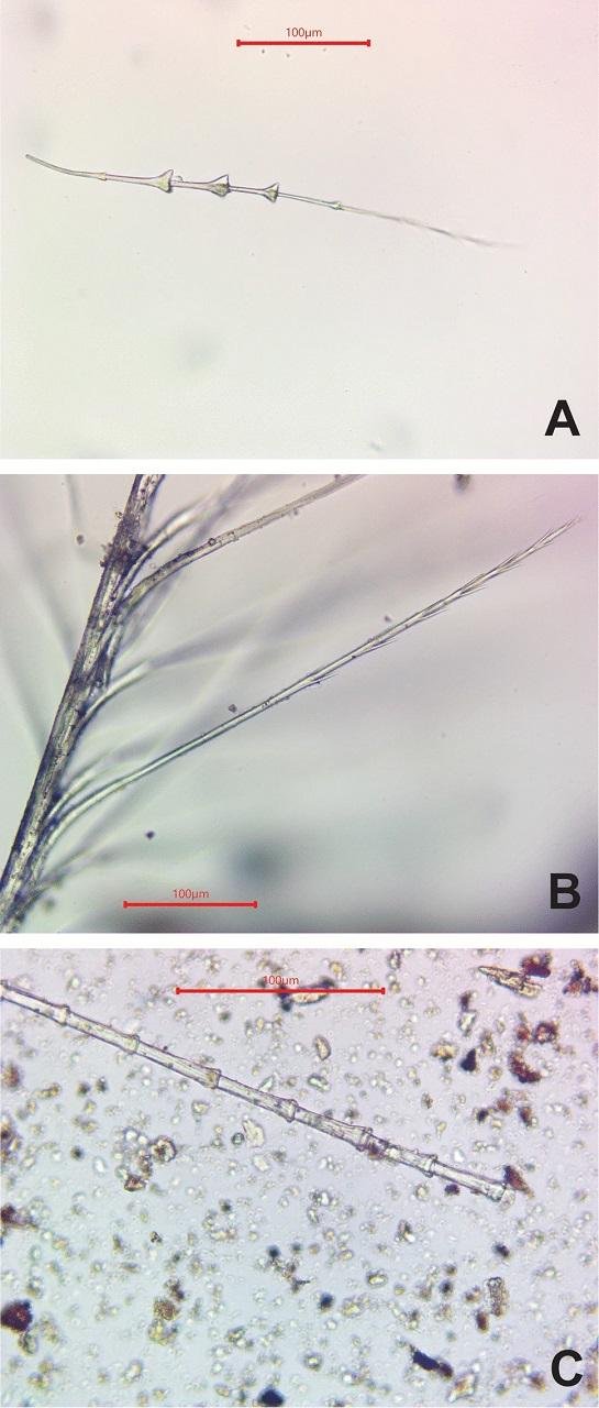 Mesolithic burials in Sweden show ancient fur and feather headgear uncovered by new microscopic analysis
