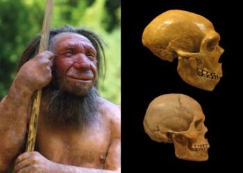 Neanderthal genes linked to rare brain-skull disorder, study finds