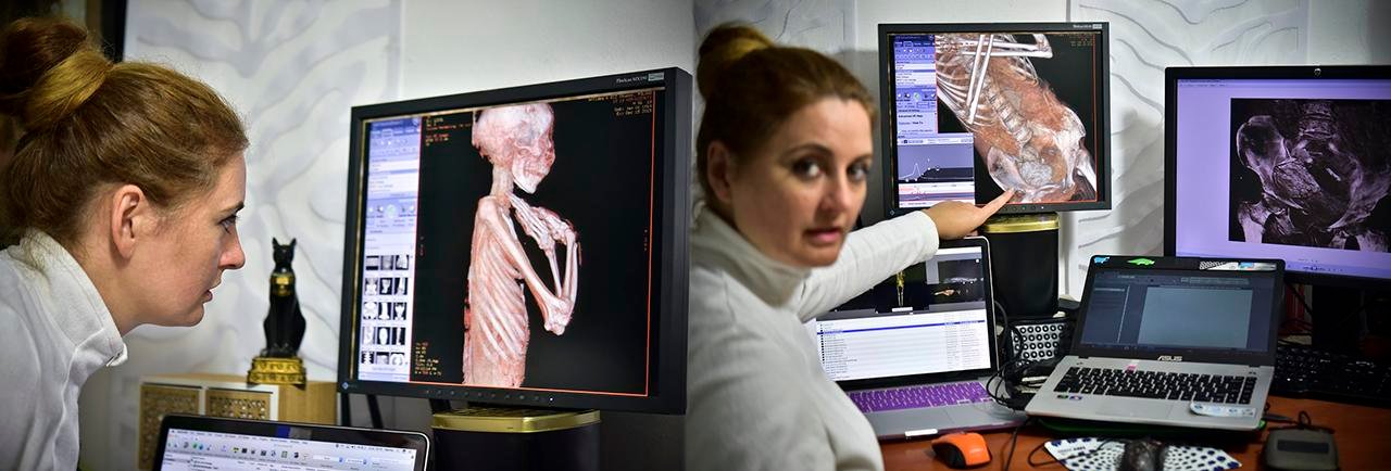 New study debunks claims of pregnancy and cancer in ‘Mysterious Lady’ mummy