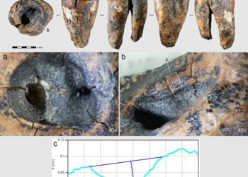 Oldest known dental treatment found in 59,000-year-old Neanderthal tooth from Siberia