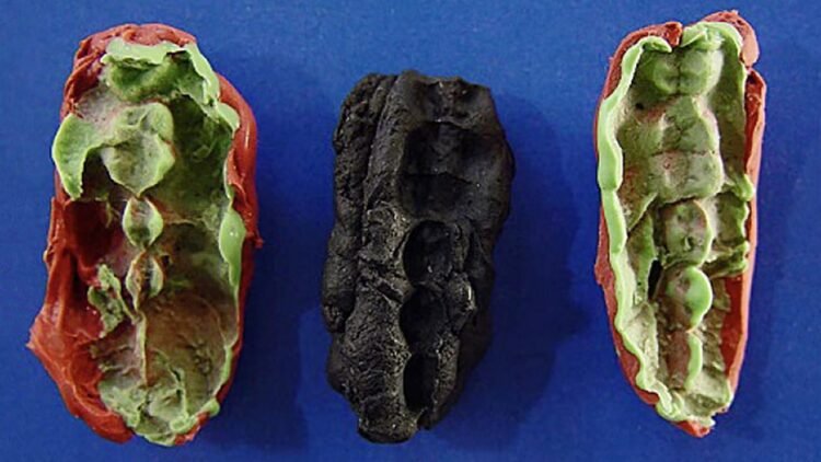 DNA from prehistoric "chewing gum" sheds light on Stone Age teenagers’ diet and oral health