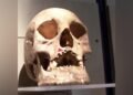 Ancient DNA reveals rare leprosy strain in the Americas thousands of years before European contact