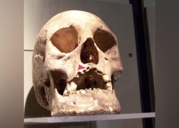 Ancient DNA reveals rare leprosy strain in the Americas thousands of years before European contact