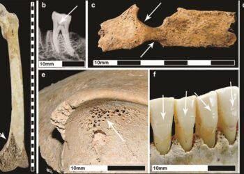 Roman urbanism was harmful to public health, new study confirms