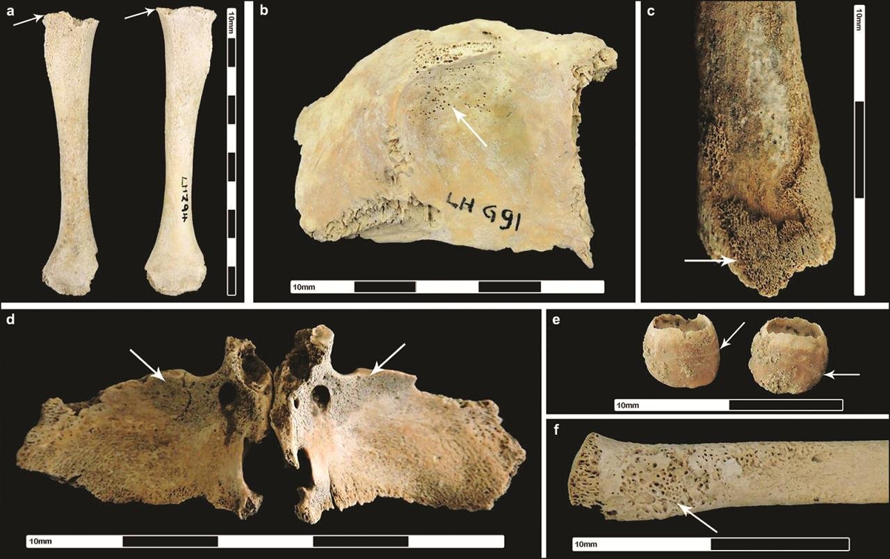 Roman urbanism was harmful to public health, new study confirms