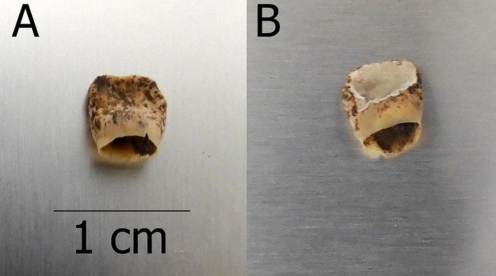 Sєx workers in medieval brothel: infant burial reveals unexpected maternal care