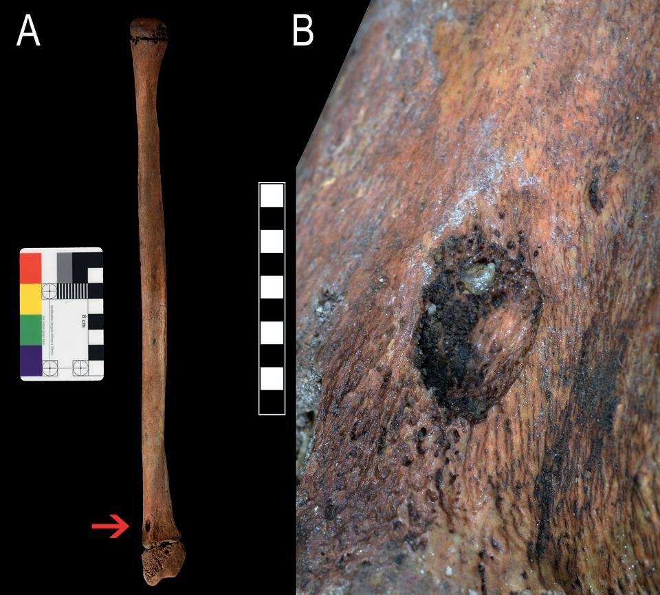 Stone Age teen buried in Italy died after bear attack 28,000 years ago, new forensic study finds