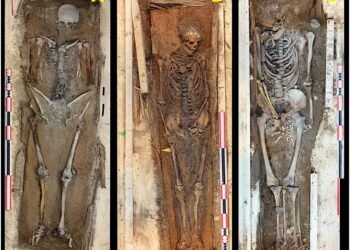 Svalbard whalers show scurvy and extreme labor stress in “corpse point” cemetery