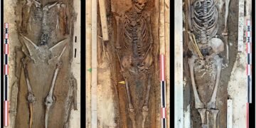 Svalbard whalers show scurvy and extreme labor stress in “corpse point” cemetery