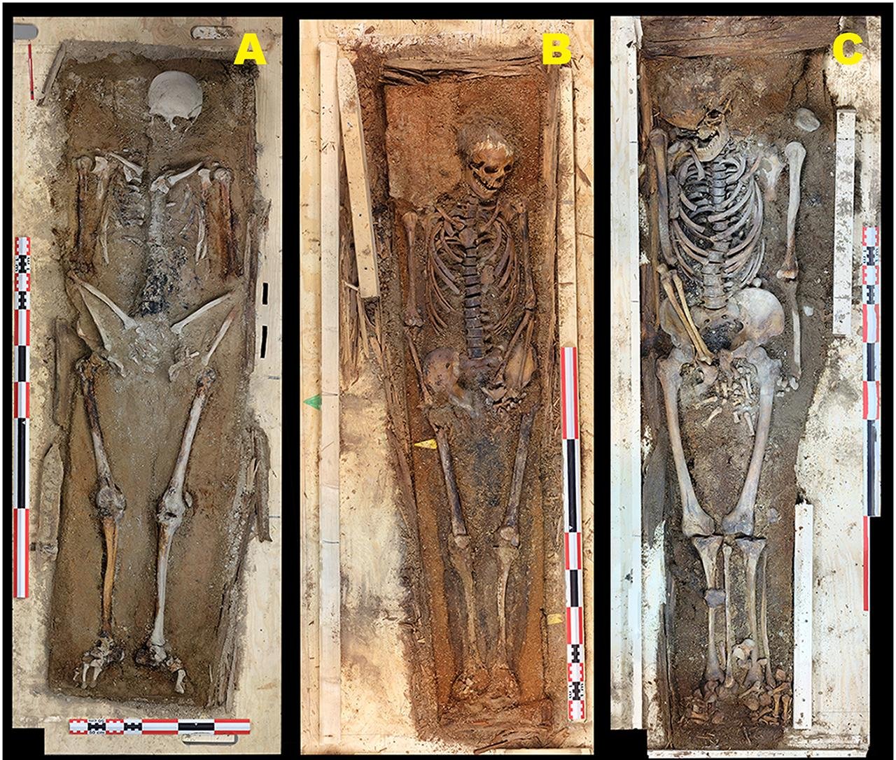 Svalbard whalers show scurvy and extreme labor stress in “corpse point” cemetery