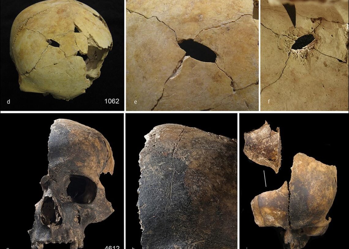 Butchered Bones Reveal Cannibalism And Violent 'othering' In Bronze Age 