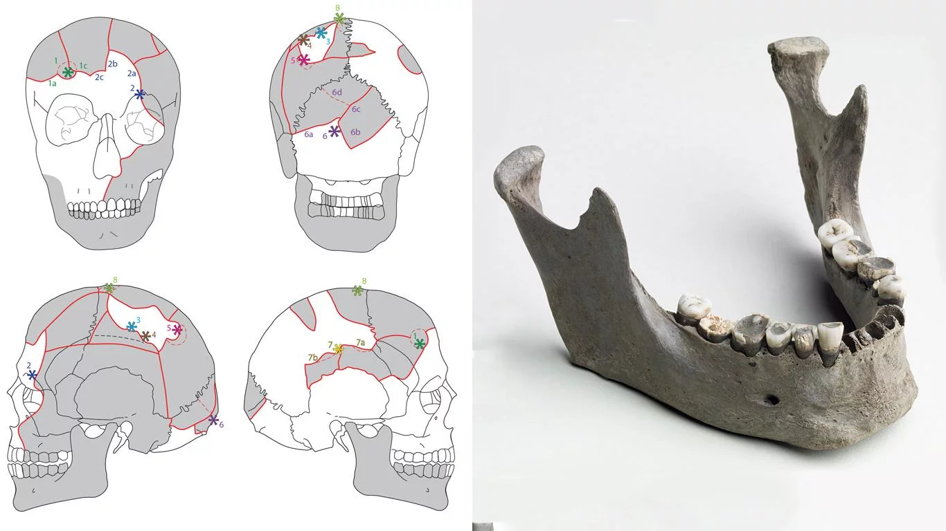 The skull of 'Vittrup Man' was smashed by eight heavy blows in a violent murder, new research finds